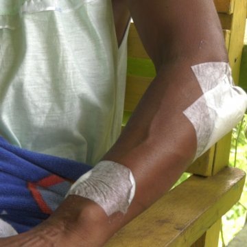 St. Ann Woman Mauled by Dogs